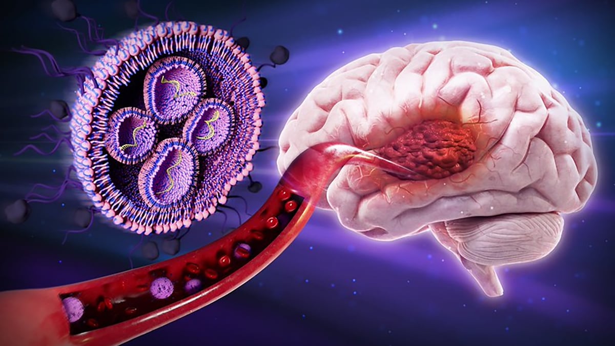 Sugar-Coated Nanoparticles Shrink Deadly Brain Tumors in Mice