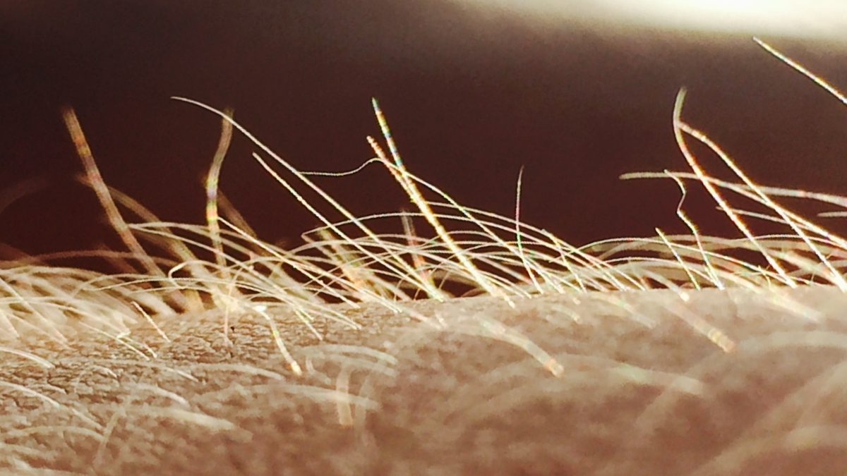 Itching May Have Its Own Sensory Organ